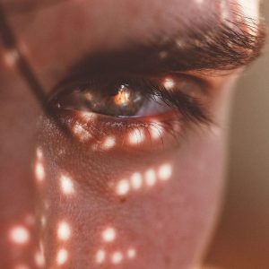 Brow Lifting