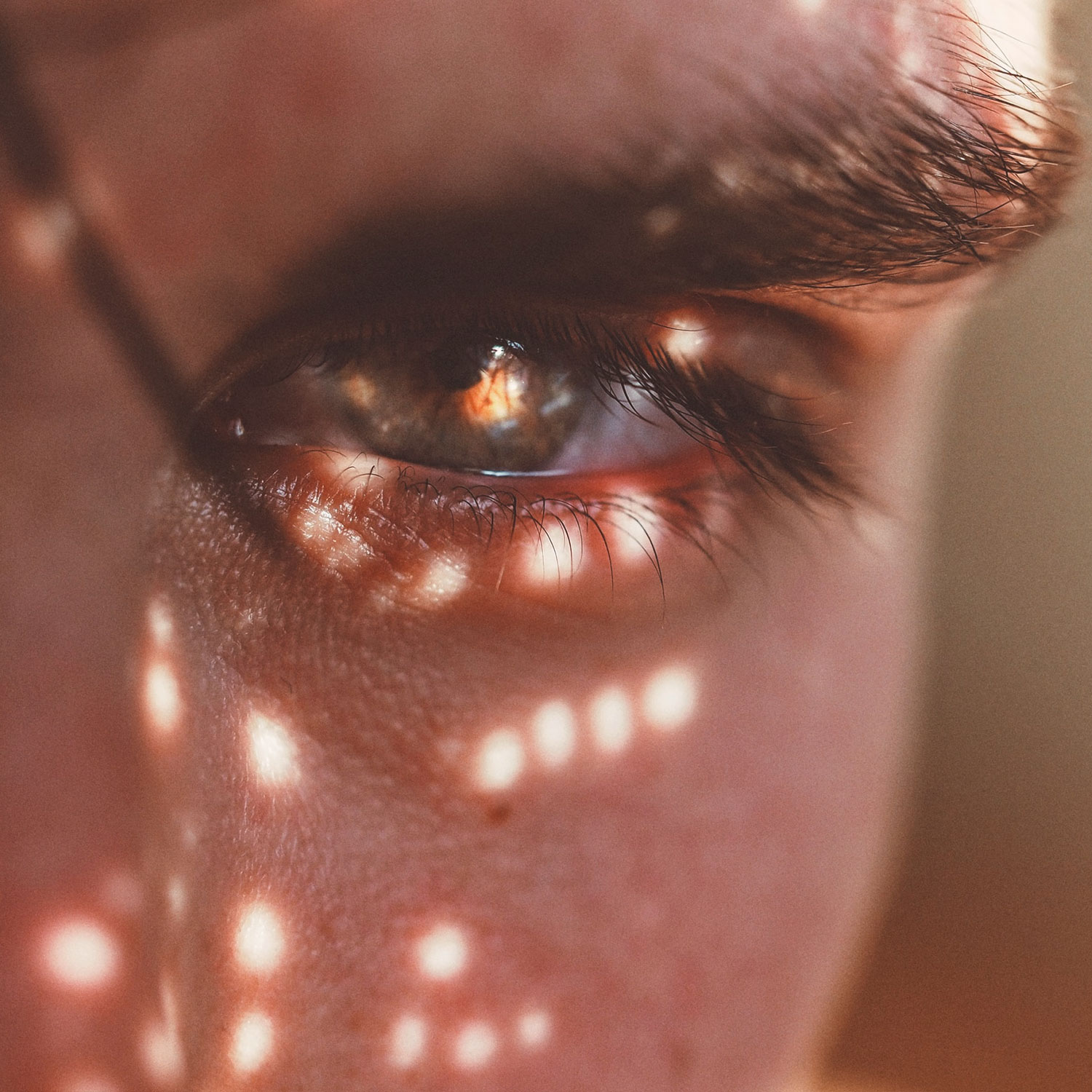 Brow Lifting