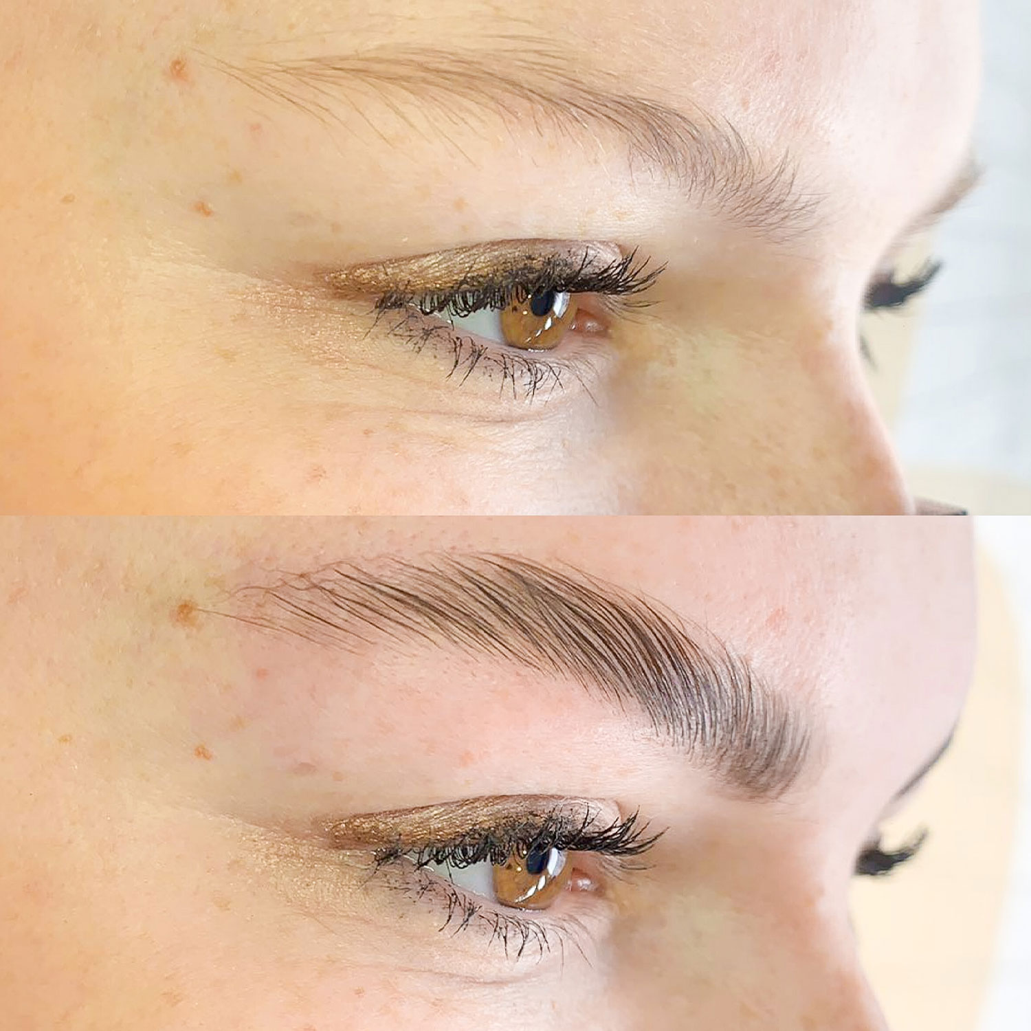Brow Lifting – Bild 3
