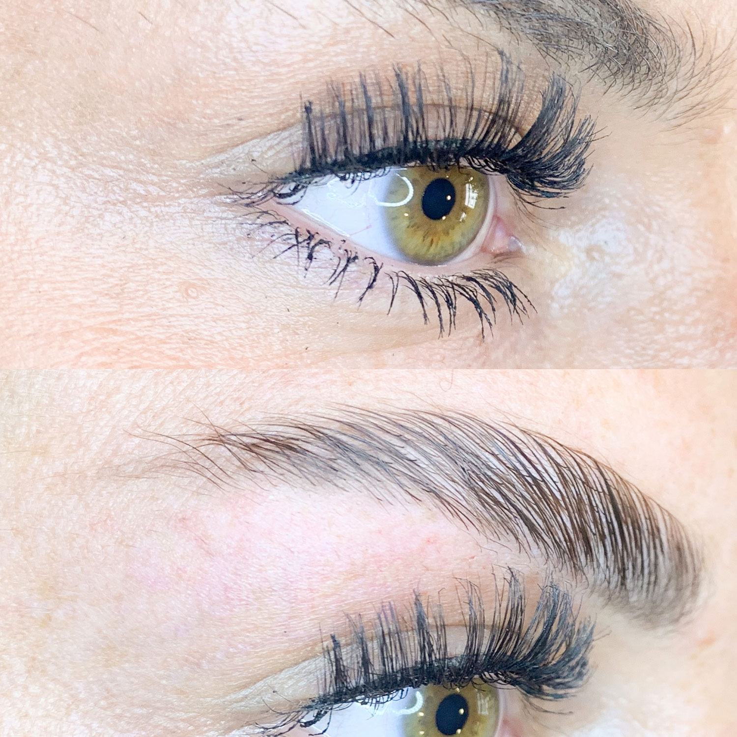 Brow Lifting – Bild 5